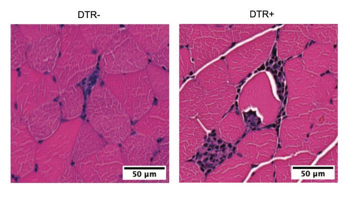 Some benefits of exercise stem from the immune system