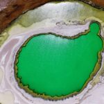 Six kidney disease companies you should know about in 2025
