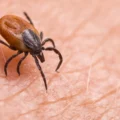 A cholesterol secret inside ticks may halt Lyme disease spread