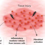 Calluna Pharma starts efficacy test with unique IPF antibody