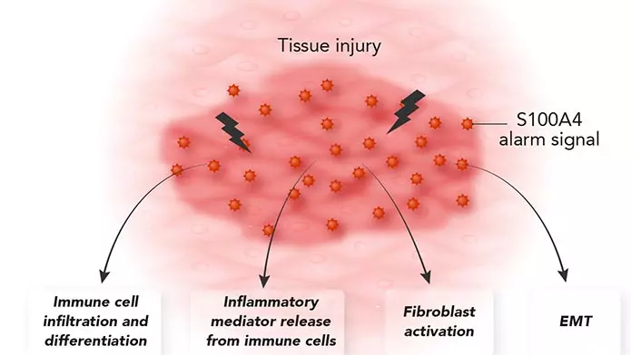 Calluna Pharma starts efficacy test with unique IPF antibody