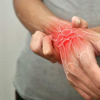 A traditional Brazilian plant shows unexpected strength against arthritis